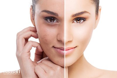 آیا ضد آفتاب پوست را روشن می‌کند؟