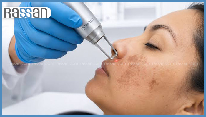 عوارض لیزر پوست صورت چیست؟ 2 عوارض جانبی موقت لیزر پوست صورت شامل التهاب و قرمزی پوست