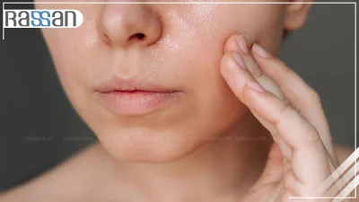 چگونه بهترین کرم برای پوست چرب را انتخاب کنیم؟