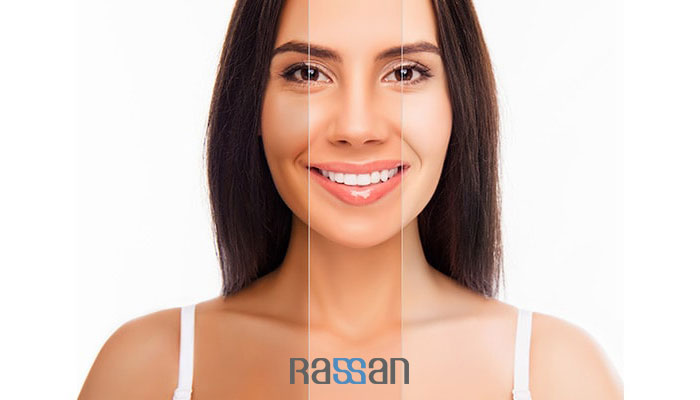 بهترین کرم سفید کننده و رفع تیرگی پوست