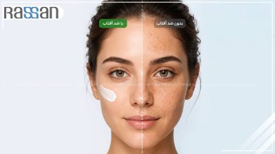 SPF چیست و چه تفاوتی بین SPF 30 و SPF 50 وجود دارد؟