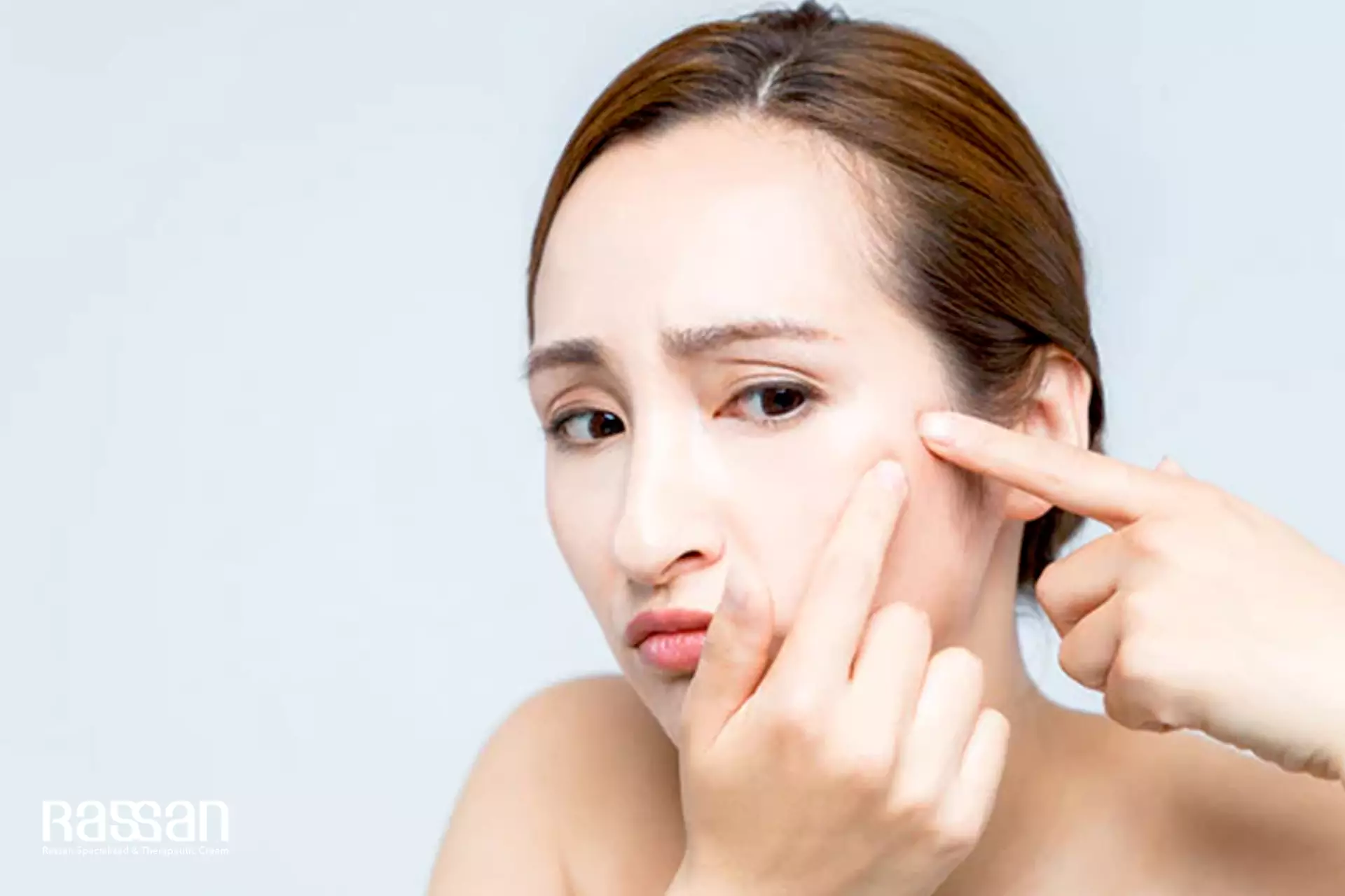 چرا بعد از مصرف مرطوب کننده جوش می زنیم؟ 1 چرا بعد از مصرف مرطوب کننده جوش می زنیم؟
