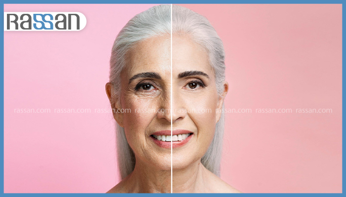 Syn Ake یا بوتاکس؟ کدام یک برای جوانسازی پوست بهتر است؟ 2 مقایسه قبل و بعد صورت یک زن مسن با موهای سفید؛ سمت چپ با چین و چروکهای عمیق دور چشم و خط خنده و سمت راست با پوست صاف و جوانسازی شده