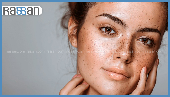 بهترین کرم برای لک قهوه ای صورت و بدن 3 روشنسازی پوست و جوانتر شدن آن