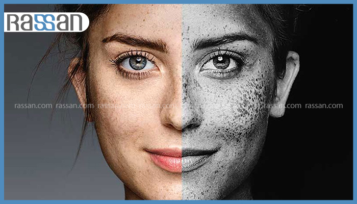 چطور در هوای آلوده از پوست خود مراقبت کنیم؟ 2 تاثیر آلودگی هوا و رادیکالهای آزاد بر ایجاد لک، کک و مک و پیری زودرس پوست صورت