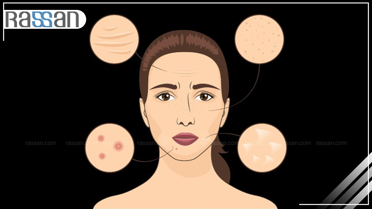 تست تشخیص نوع پوست انلاین