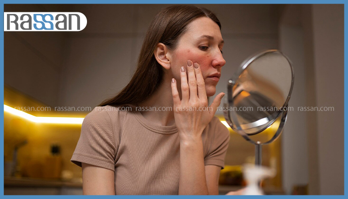 زنی در حال بررسی قرمزی، حساسیت و التهاب پوست صورت خود در آینه اتاق، برند راسن